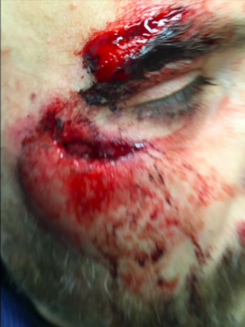 BleedStop Testimonials 4