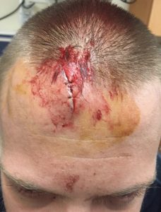 BleedStop Testimonials 5